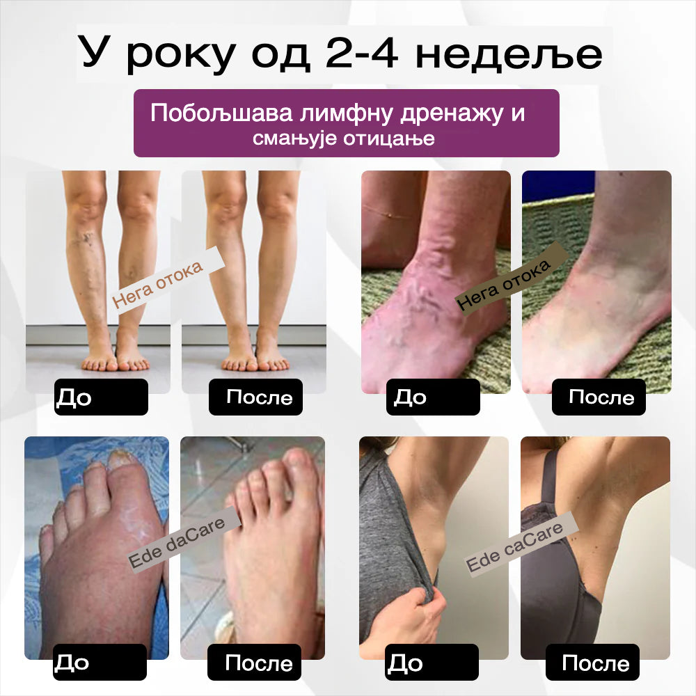 EdemaRelief Limfna Detox Krema