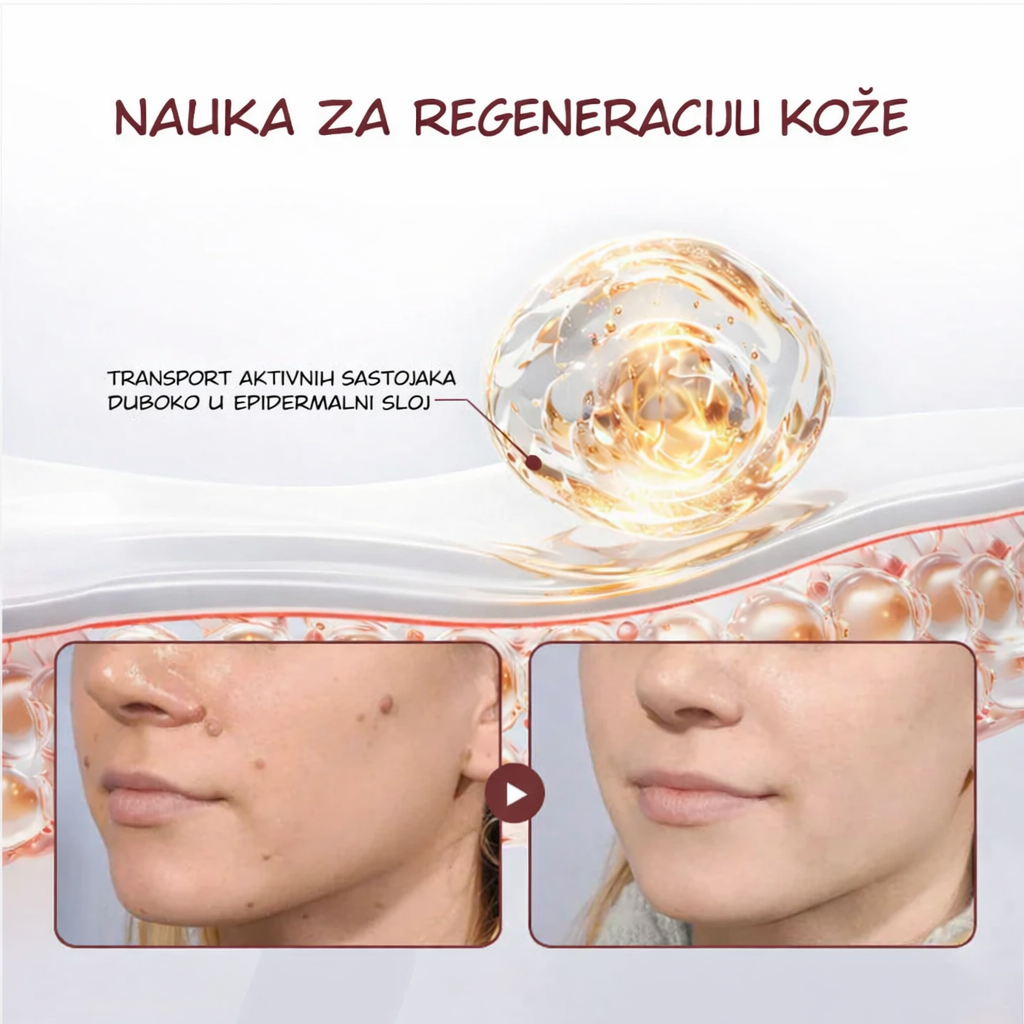 KeraErase – Ponovo otkrijte glatku, čistu i lepu kožu
