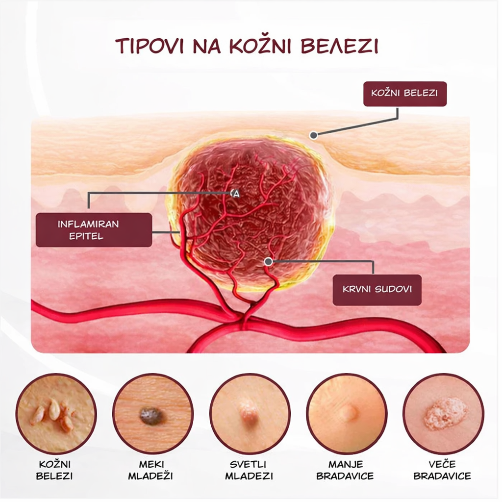 KeraErase – Ponovo otkrijte glatku, čistu i lepu kožu